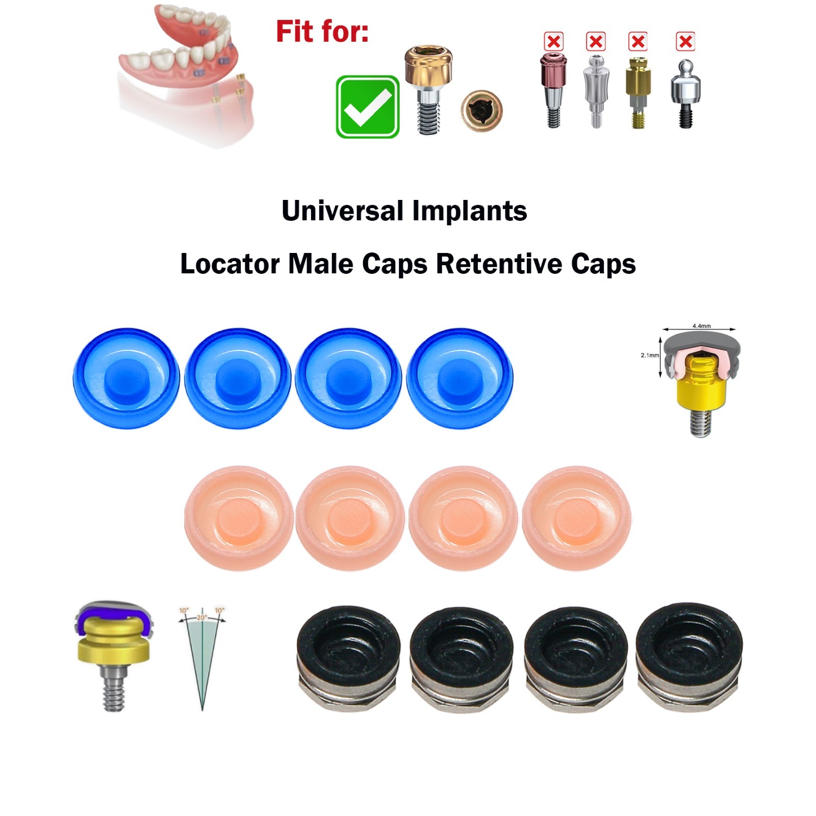 Universal Overdenture Implant Retention Caps – Metal Housing, 1.2 lbs & 2.4 lbs