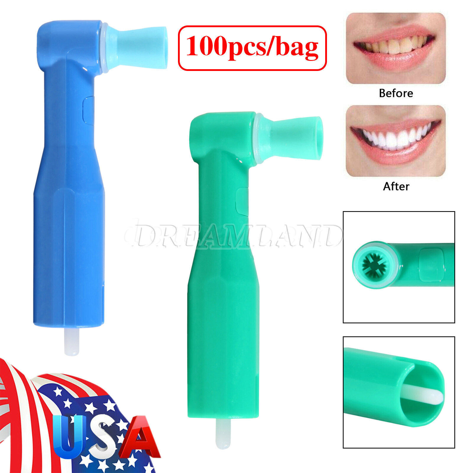 Dental Disposable Prophy Angles Contra Angles Top Quality Money Back Guarantee!