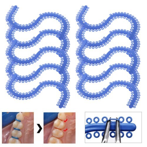 Dental Orthodontic Separate Tie Blue Color Spacers S-type Supply tooth Separator